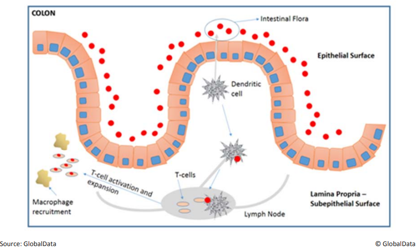 Рис. 2. Механизм развития воспалительных заболеваний кишечника. Кишечная микрофлора (красные кружки) захватывается дендритными клетками, воспринимается как чужеродный объект и в лимфоузле презентируется T-клеткам. T-клетки активируются и делятся, привлекают макрофаги, в кишечнике возникает иммунный ответ