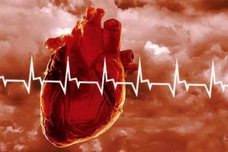 infarct_miocard-449x299
