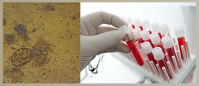 Анализ кала на глисты, общий анализ крови