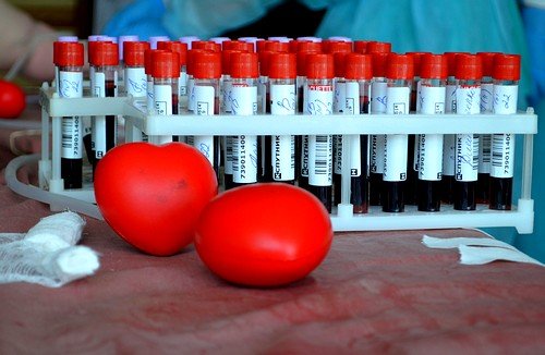 3-5% - общее переливание зараженной донорской крови