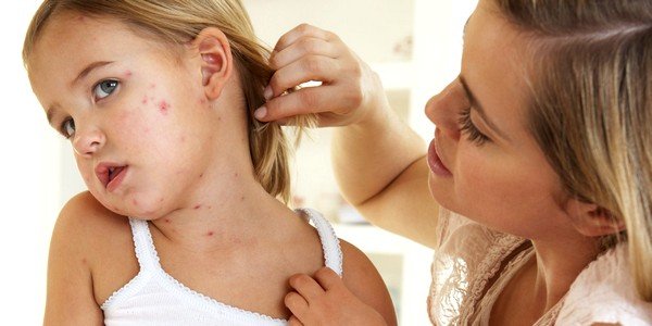 Паразиты могут вызвать разнообразные аллергические реакции и высыпания на коже