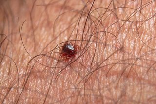 Tick on darker skin