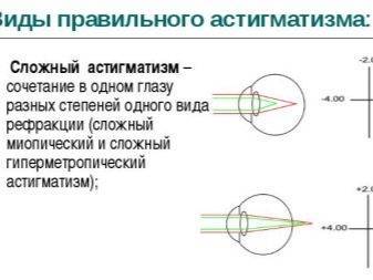 Астигматизм гиперметропический у детей что это такое