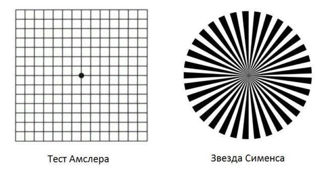 Астигматизм гиперметропический у детей что это такое