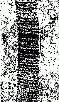 Электронная микрофотография  коллагеновой фибриллы. Фигурной скобкой обозначен период повторяемости полос.