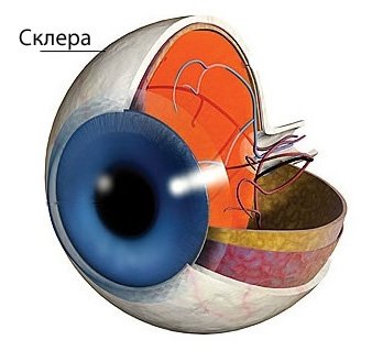Ослабление ткани склеры