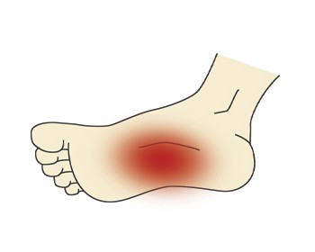 растяжение связок ноги симптомы