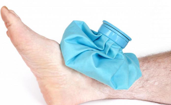 как лечить порванные связки на ноге 