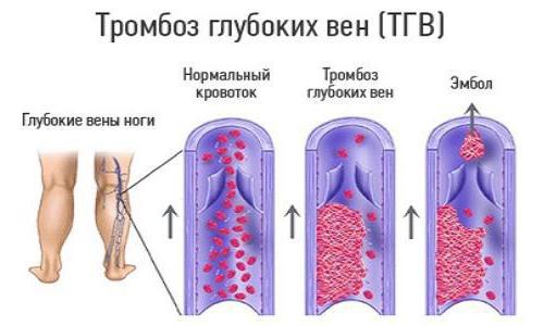 антикоагулянты непрямого действия список