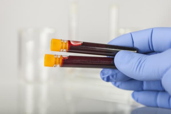 Анализ крови на антитела