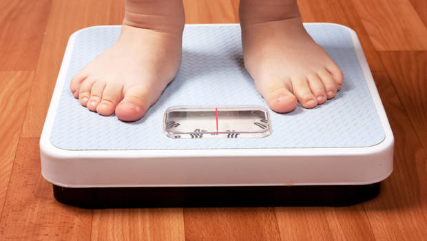 избыточный вес у ребенка