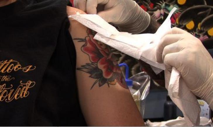 Лечение прыщей на татуировке
