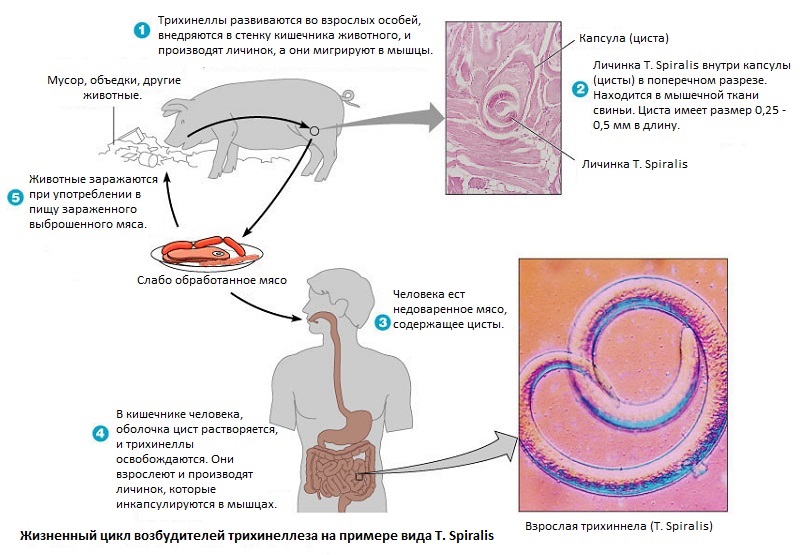 Жизненный цикл трихинелл