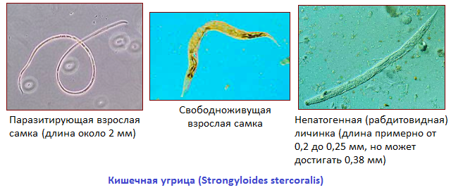 Кишечная угрица (Strongyloides stercoralis)