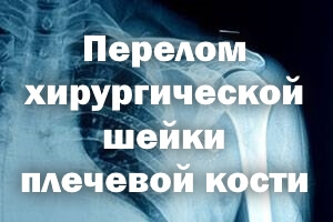 Перелом хирургической шейки плечевой кости