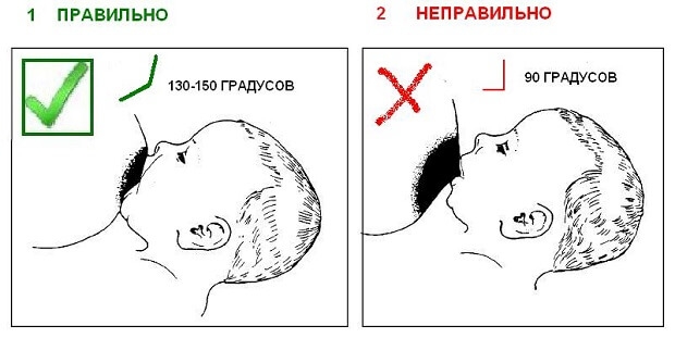 отчего могут болеть соски