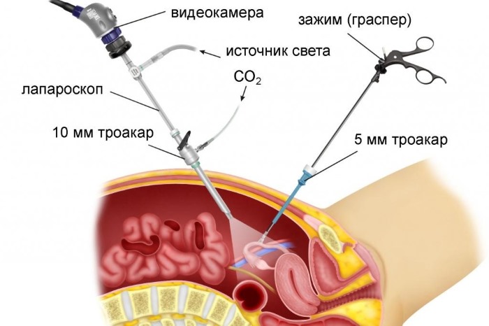 Желтое тело в яичнике - что это такое на узи при беременности, задержке, перед, после месячных, овуляции. Тест положительный и отрицательный