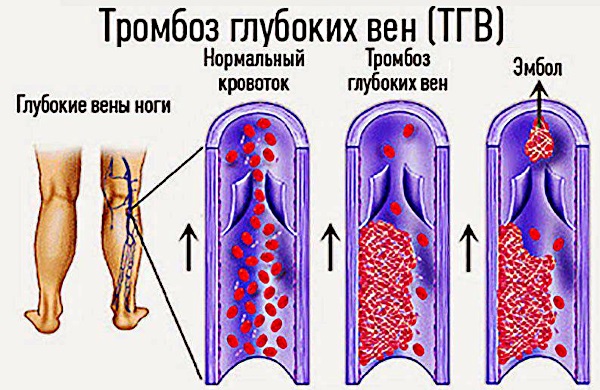 Болят ноги от колена до ступни. Причины и лечение народными средствами, медикаменты. К какому врачу обратиться