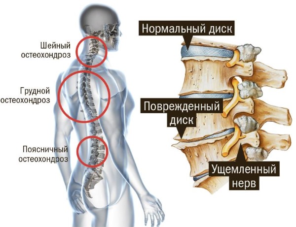 Жжение языка, неба, губ, горла. Причины и лечение у взрослых народными средствами