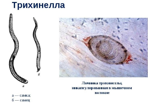 Глистная инвазия. Симптомы, диагностика и лечение у взрослых и детей