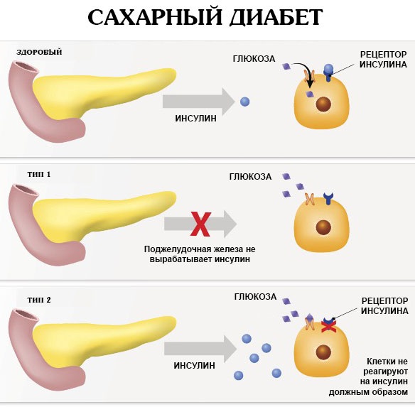 Красный плоский лишай у человека. Фото, стадии, признаки, лечение. Клинические рекомендации