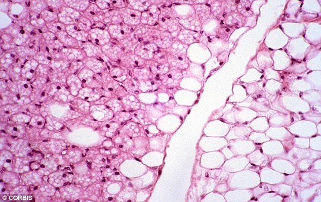 White fat cells (right) accumulate in the body when a person eats too many calories, but fails to burn them off. Brown fat cells (left) burn excess energy, and help reduce the size and number of white fat cells, thus helping a person to lose weight
