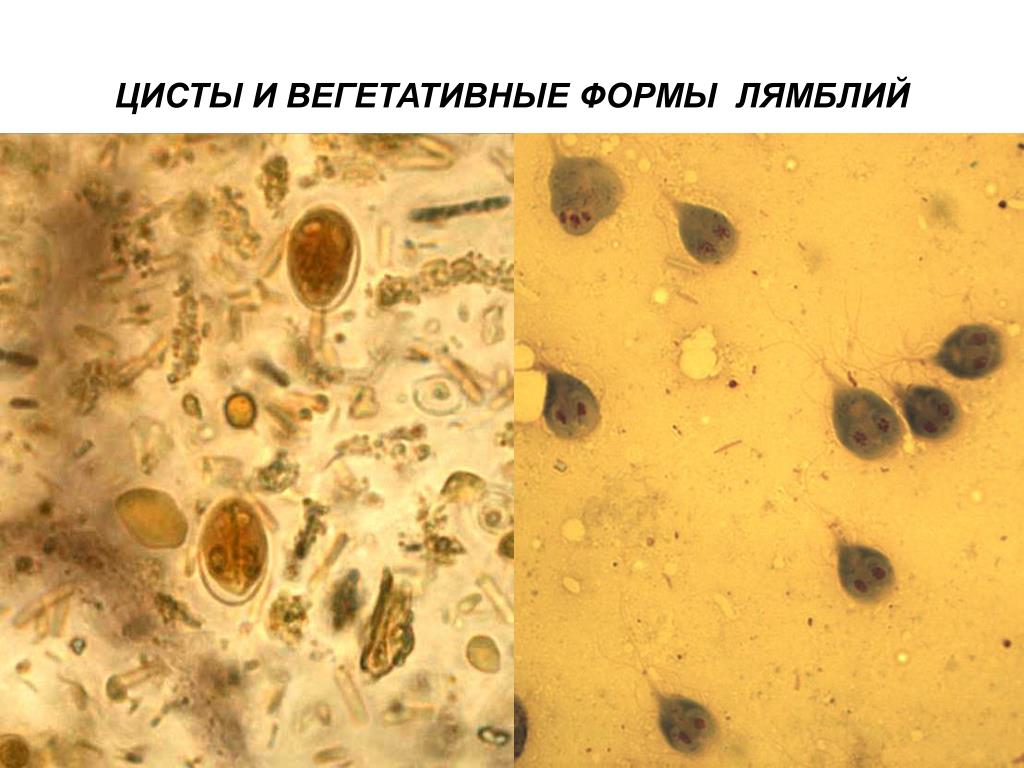 Бактерии в копрограмме. Цисты лямблий микроскопия кала. Цисты лямблий микроскопия. Лямблии микроскопия кала.