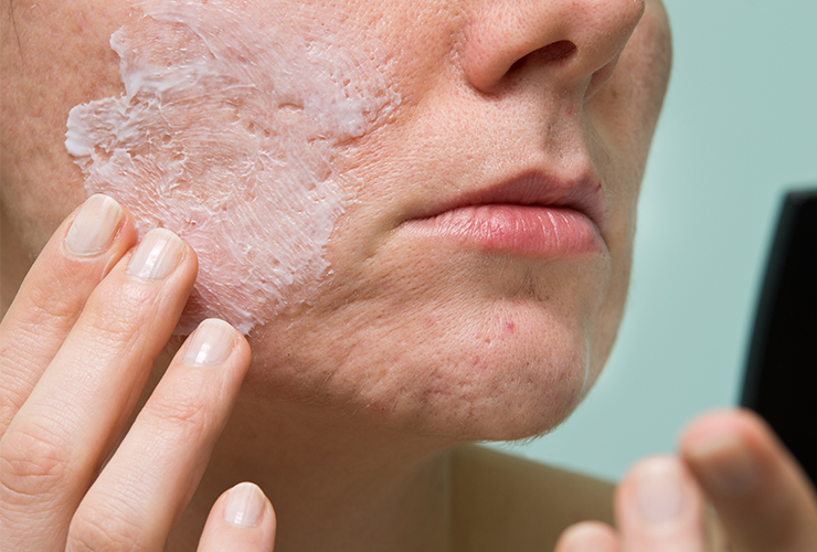 acne face masks