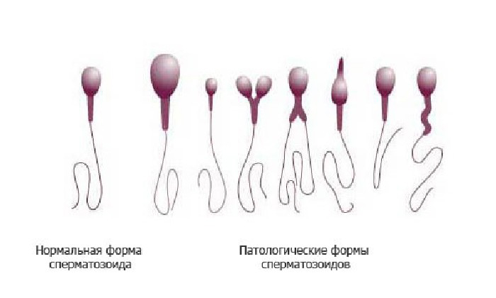 Результаты спермограммы