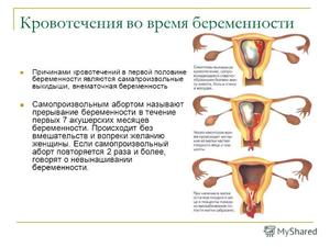 Выделения во время беременности