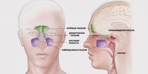 Обследование придаточных пазух носа