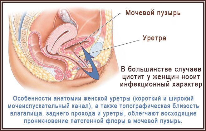 система