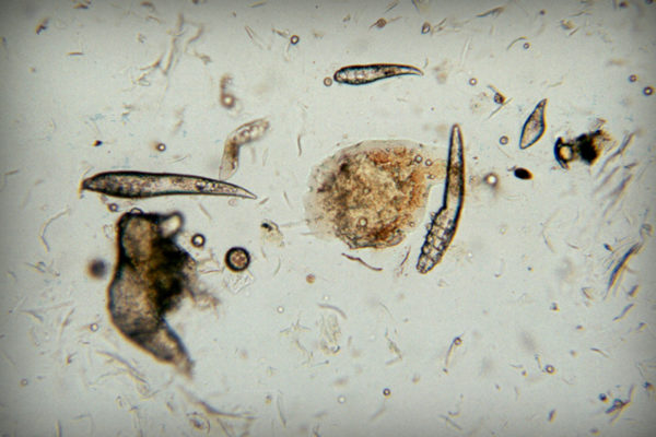 Яйца, личинки и клещи в объективе микроскопа