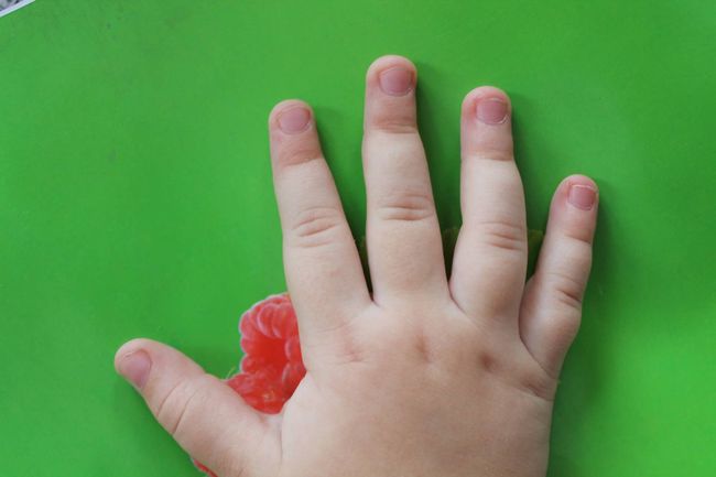 У детей ногти чаще всего слоятся из-за авитаминоза