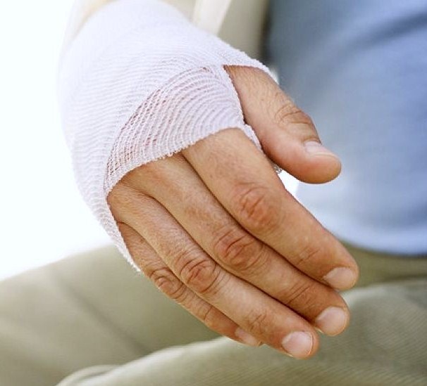Как определить перелом руки