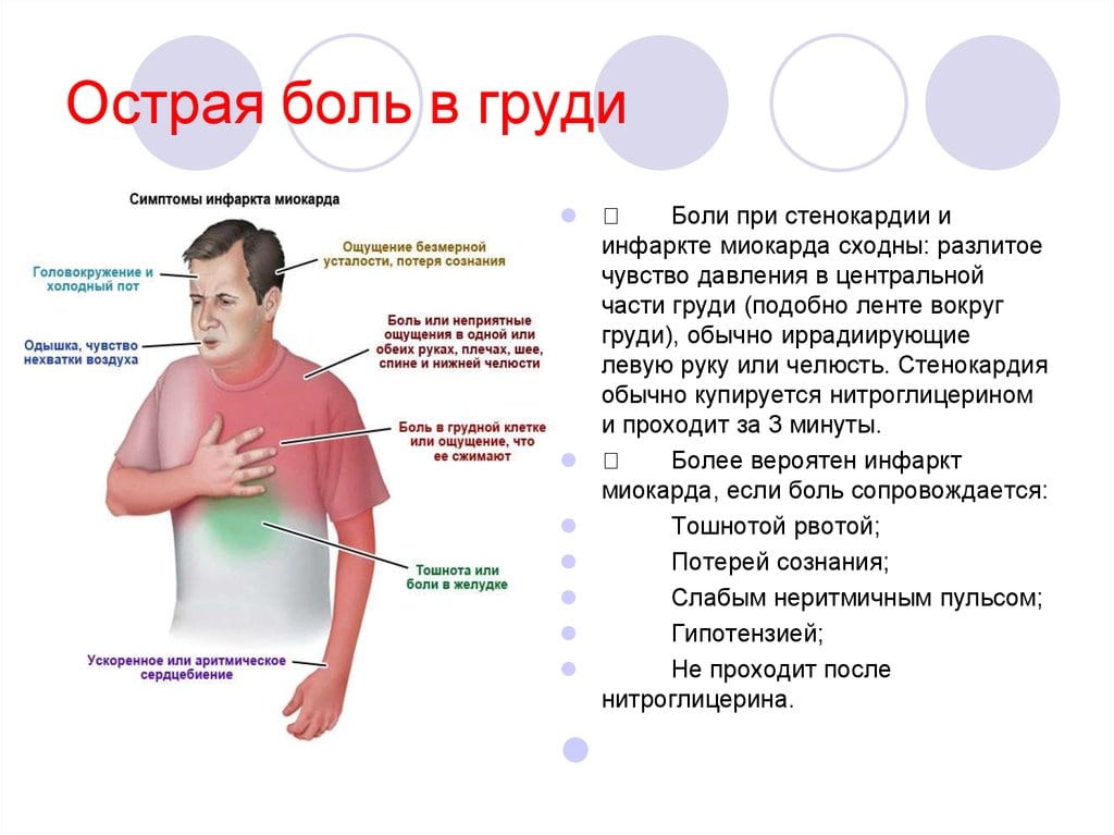 Сколиоз позвоночника 