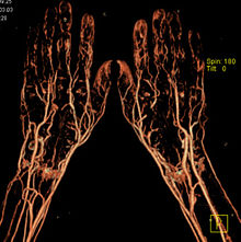 CT-Angiografie-Haende.jpg
