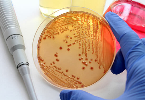 Как выглядят бактерии в чаше Петри