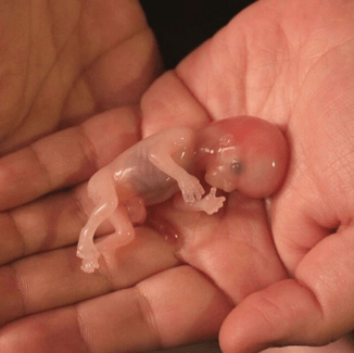 Эмбрион в руке