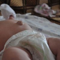 пупок новорожденного выпирает