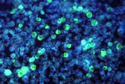 This photomicrograph depicts leukemia cells that contain Epstein-Barr virus using an FA staining technique.