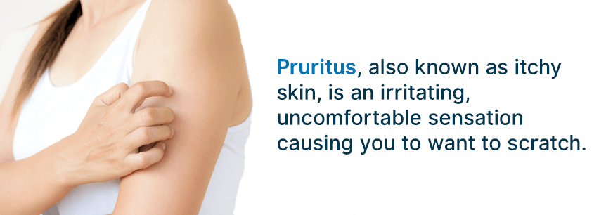what is pruritus