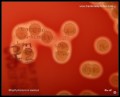 detail of staphylococcus aureus colonies with beta hemolysis on blood agar