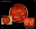 staphylococcus aureus hemolysis on blood agar