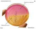 s.aureus and s.epidermidis appearance on mannitol salt agar