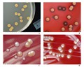 pigmented bacterial colonies