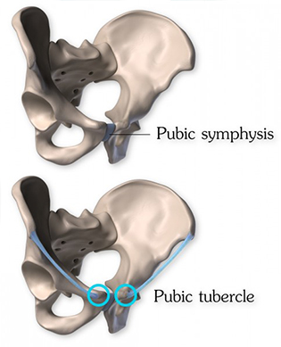 Pubic synthesis and pubic tubercles