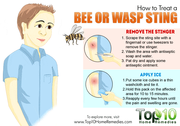 treat a bee or wasp sting