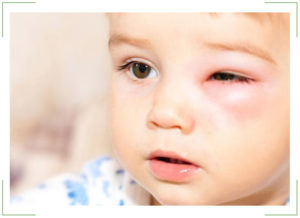 Глазные капли от конъюнктивита для детей